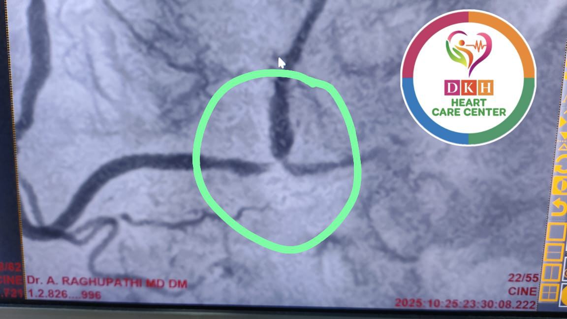 Medical Angiogram Image 6